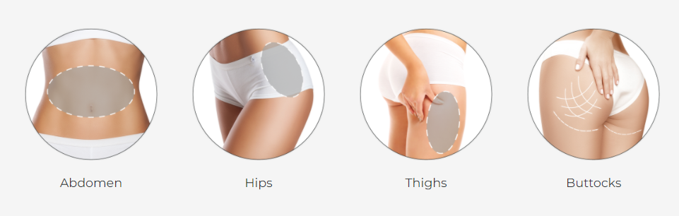 Best price cryolipolysis slimming machine cryotherapy weight lose fat freezing