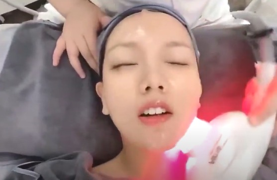 1300nm Nir Nearlight Milk Light Skin Rejuvenation Pulse Machine