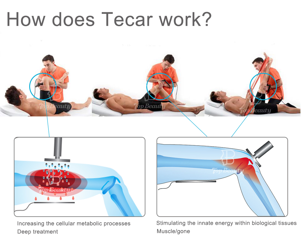 448KHZ Indiba Tecar Diatermia Pain Relief Physiotherapy Machine