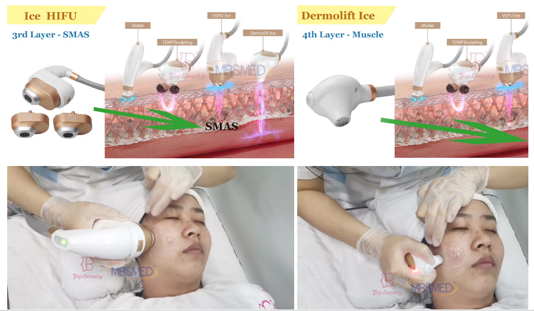 12D ICE hifu machine face lifting hifu Skin tighten HIFU machine
