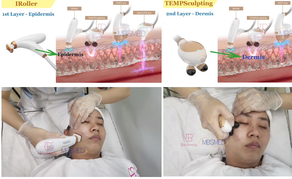 12D ICE hifu machine face lifting hifu Skin tighten HIFU machine