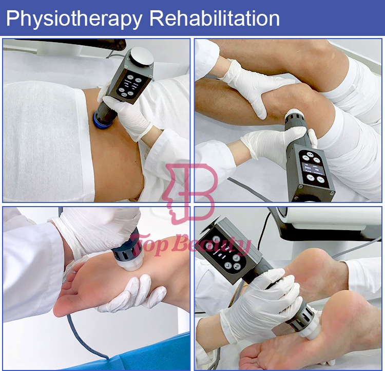 Focus Shockwave Therapy Erectile Dysfunction Machine For Pain Refile