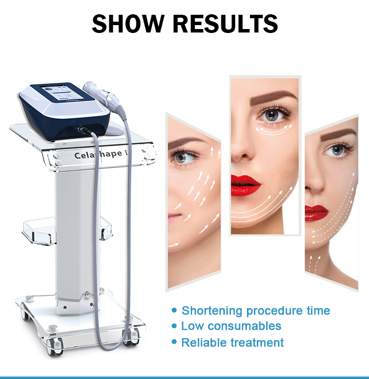 5 Heads for Facial Beauty Equipment Radio Frequency RF Face Lifting and firming Wrinkle Removal Skin Tightening RF Machine