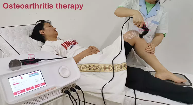 portable pain relief 448Khz tecar therapie indiba physical rehabilitation tecar wave therapy machine