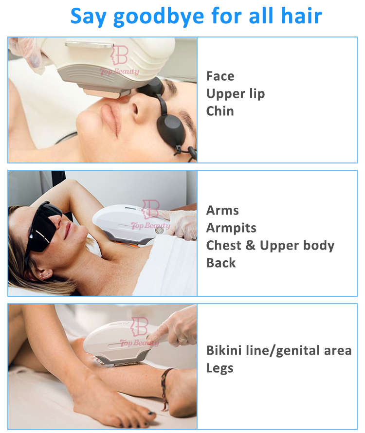 New type intense pulsed light therapy IPL hair removal machine