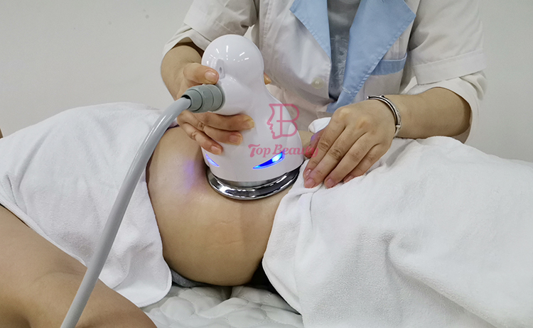 5D Roller Body Sculpting Cellulite Roller Endosferas Slimming Vacuum Therapy Machine