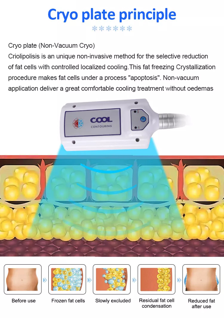 2023 New Fat Loss Cryo Pads Slimming Machine Cryolipolysis Machine Coldtec Fat Freeze Cryolipolysis Device