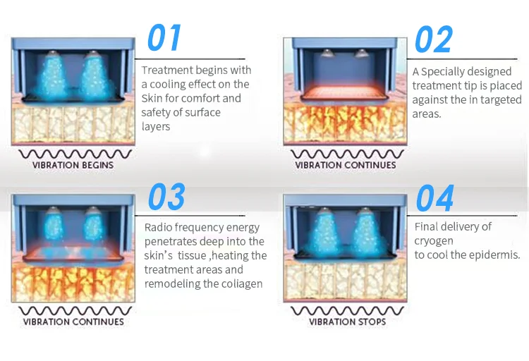 2024 skin tightening 2 in 1 Flx face lift hifu skin rejuvenation rf machine