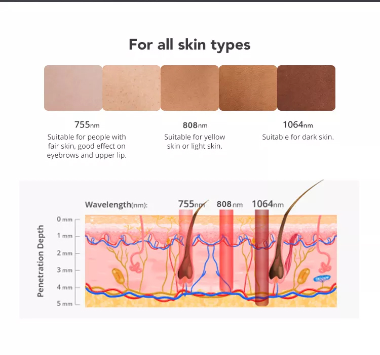 professional 808nm Diode laser hair removal machine