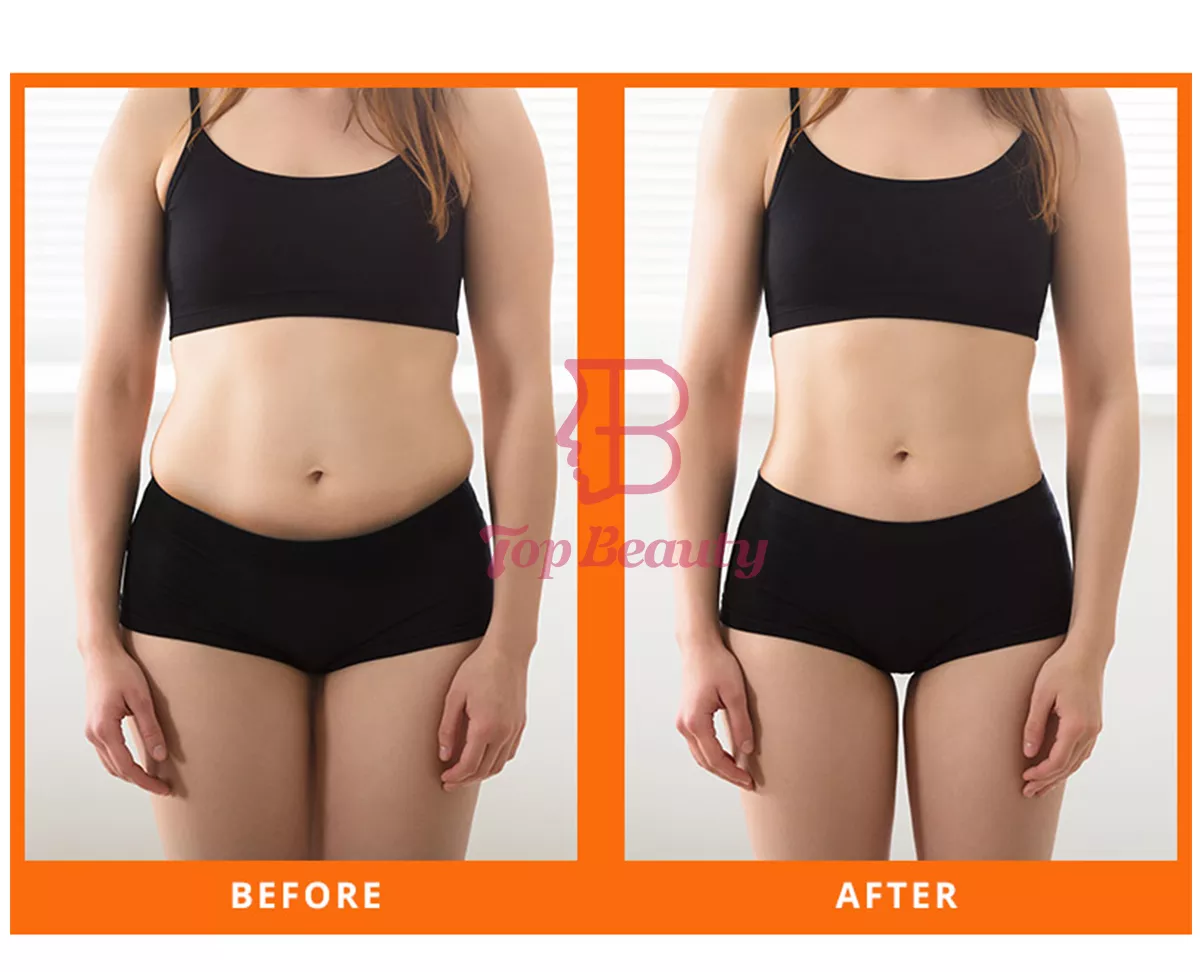 80k cavitation body shaping slimming fat burning cavitation machine