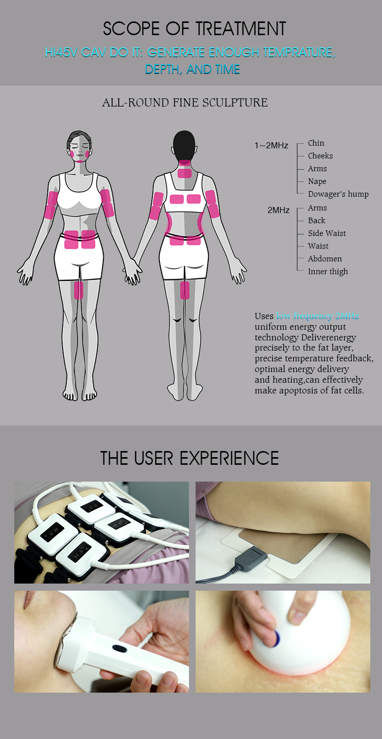 3 in 1 Salon Use Trusculpt Id Flex Rf Body Contouring Body Sculpting 2mhz Cellulite Treatment Fat Reduction Trufat Machine