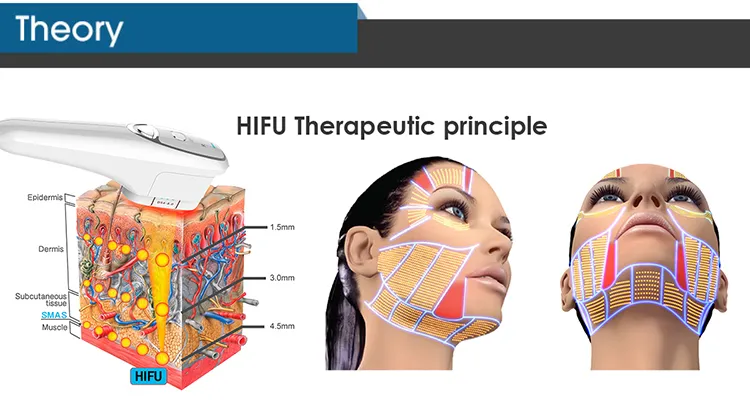 360 ° rotate display ultrasound skin rejuvenation Wrinkle Removal vertical 4D MMFU Machine