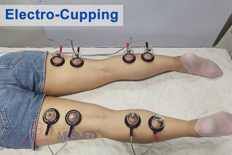 EMS Muscle Stimulator Body Slimming Russian Wave Electrostimulation Fair Cupping Breast Vacuum Therapy Machine