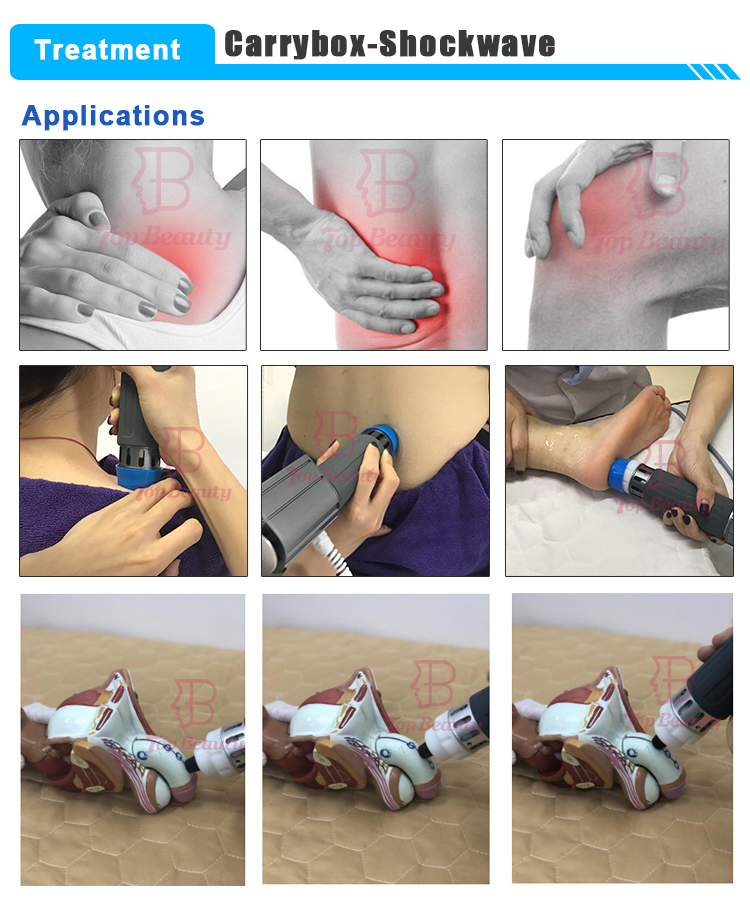 Electromagnetic Shockwave Therapy Fswt Erectile Dysfunction Pain Relief Machine