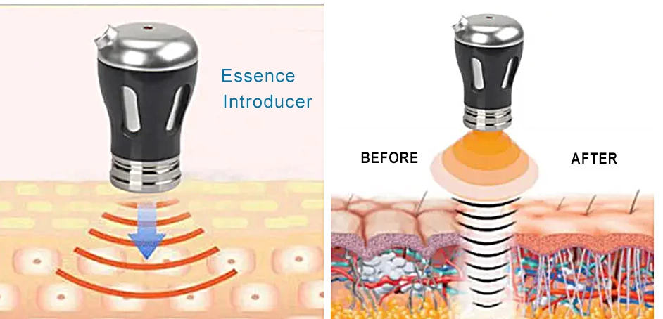 2 in 1 RF Beauty import Device EMS beauty product Machine anti aging face lift device wrinkles remove Ultrasound EMS Therapy Machine