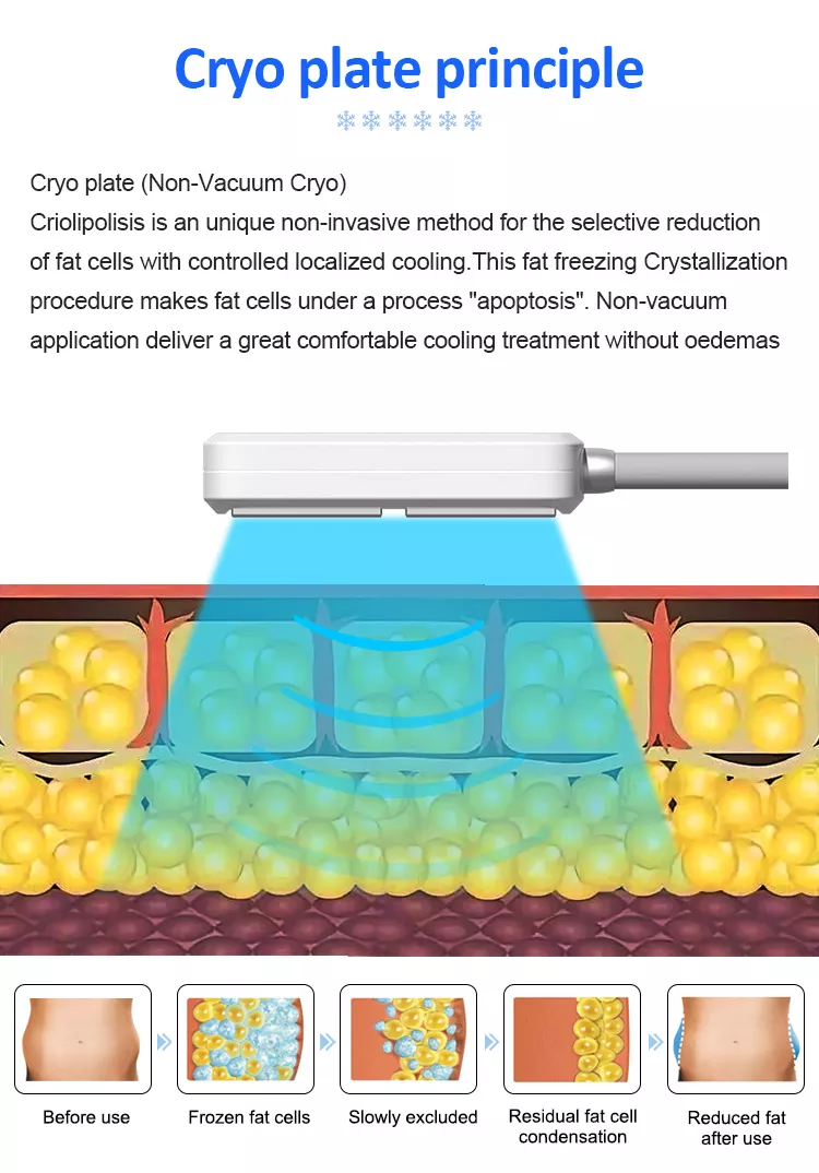 2023 New Painless Cryolipolysis Belly Slimming Cryo Plate Cooling Pads Fat Freezing EMS Machine