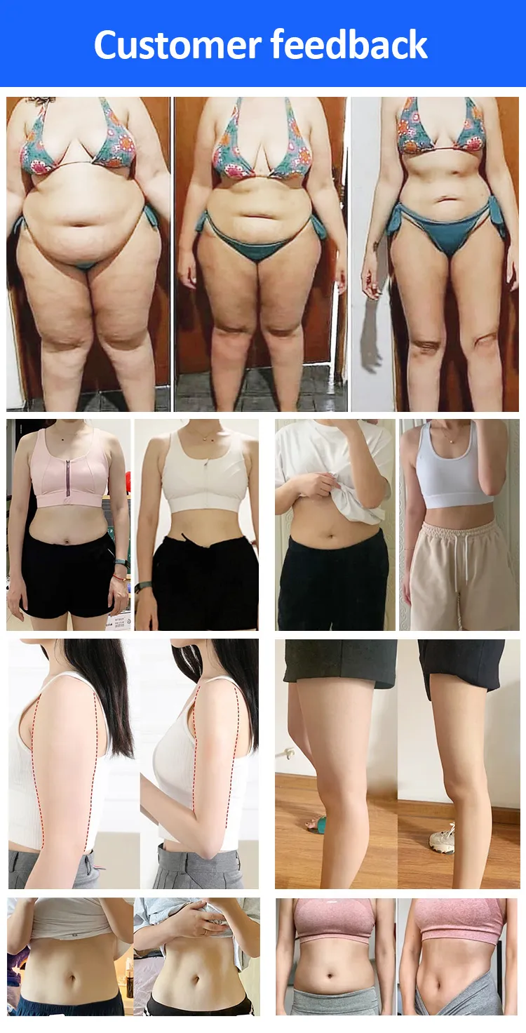 Portable Fat Freezing Machine Slimming Fat Cellulite Removal Cryotherapy Device Cryo Plates With EMS