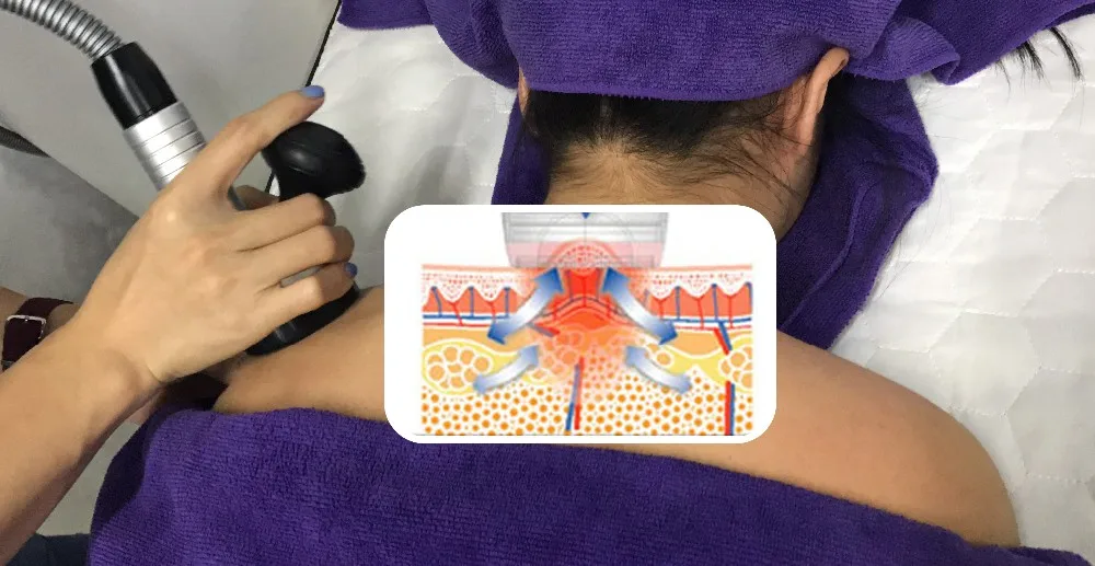 Body EMShapeing 4 In 1 Vacuum Roller RF Machine