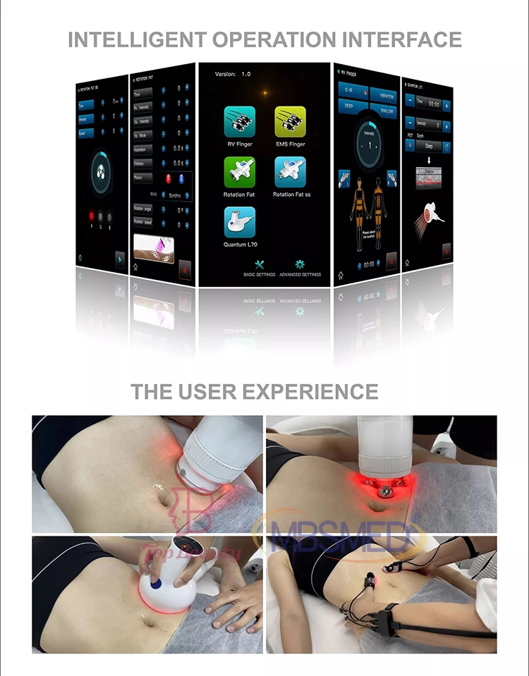 360 Rotation Vacuum Roller RF Body Slimming Machine