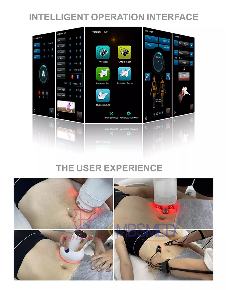 360 Rotation Vacuum Roller RF Body Slimming Machine