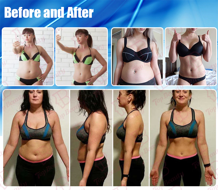 Lipo Cavitation Machine 80k Cavitation Slimming Machine vacuum Cavitation System Liposuction Kim 8 Slimming System -