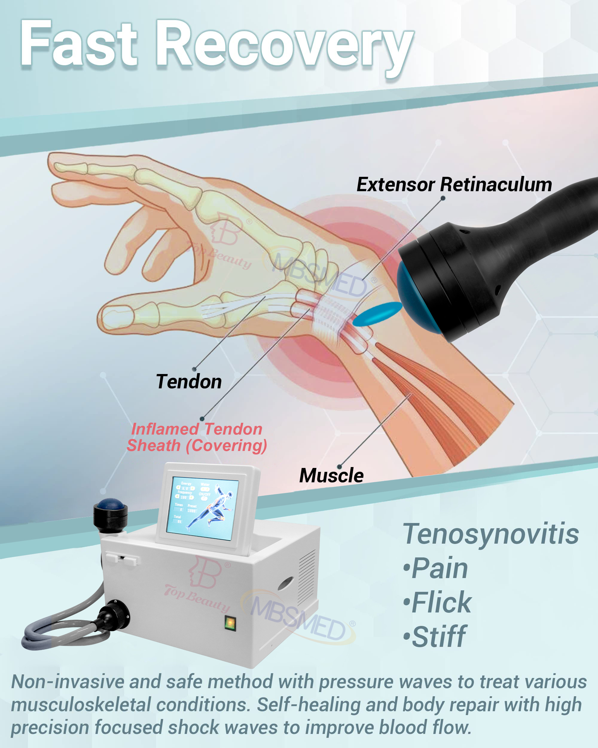 hot sale eswt ed focus shockwave system shock focused shockwave therapy machine,Shockwave Physical