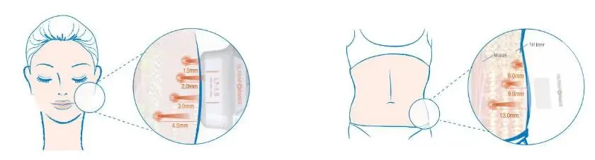 2024 skin tightening 2 in 1 Flx face lift hifu skin rejuvenation rf machine