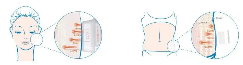 2024 skin tightening 2 in 1 Flx face lift hifu skin rejuvenation rf machine