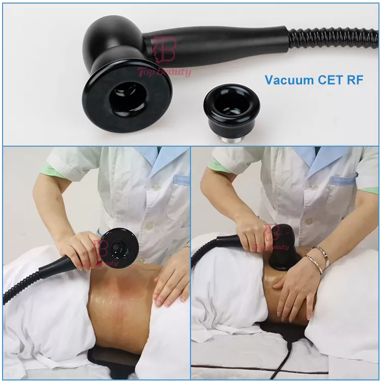 448khz Vacuum Rf Tecar Therapy Machine Indiba Rf Wrinkle Removal Body Slimming Machine Radio Frequency
