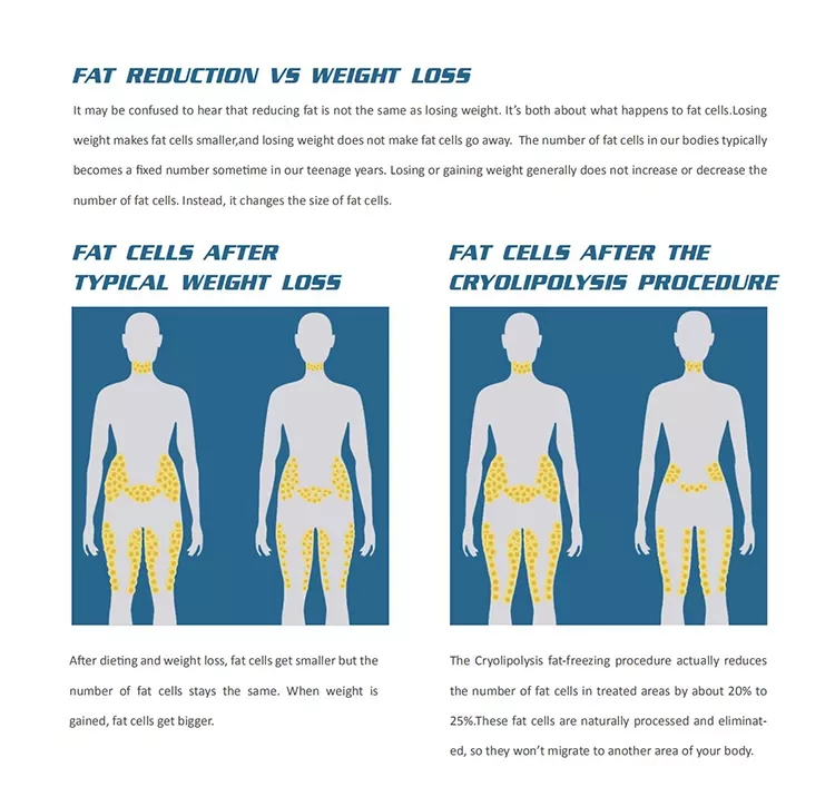 2022 Factory Sale 360 Cryolipolysis Slimming Machine / Fat Freezing Machine Cool Tech Cellulite Reduction