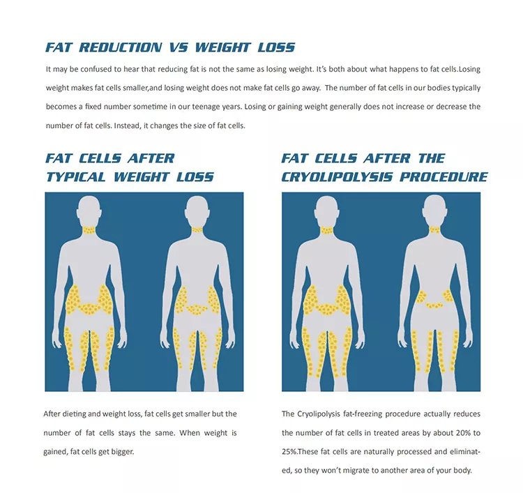2022 Factory Sale 360 Cryolipolysis Slimming Machine / Fat Freezing Machine Cool Tech Cellulite Reduction