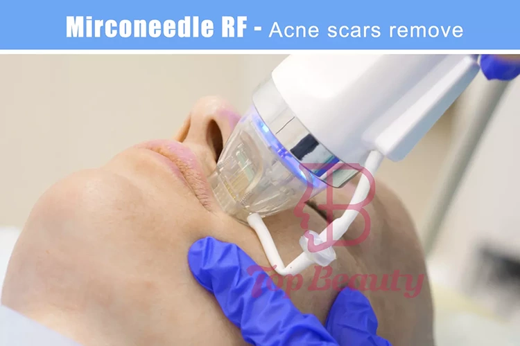 microneedling fractional rf microneedle machine