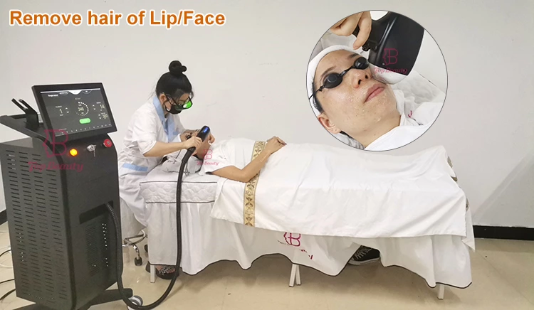 professional 808nm Diode laser hair removal machine