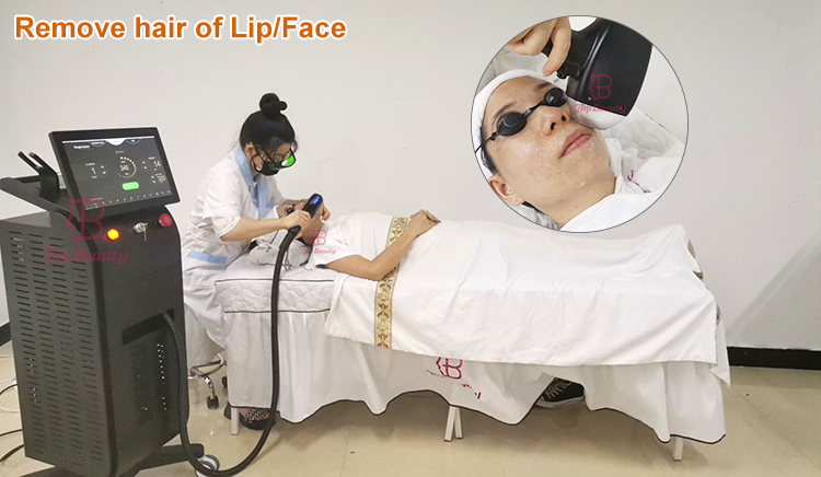 professional 808nm Diode laser hair removal machine