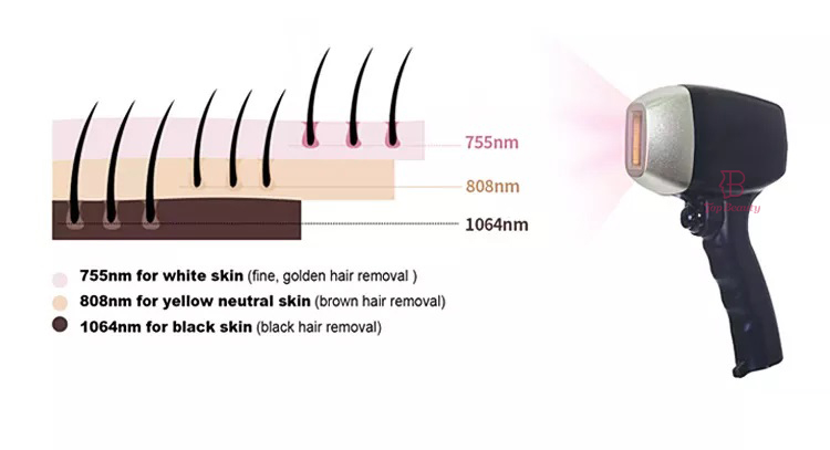 professional 808nm Diode laser hair removal machine