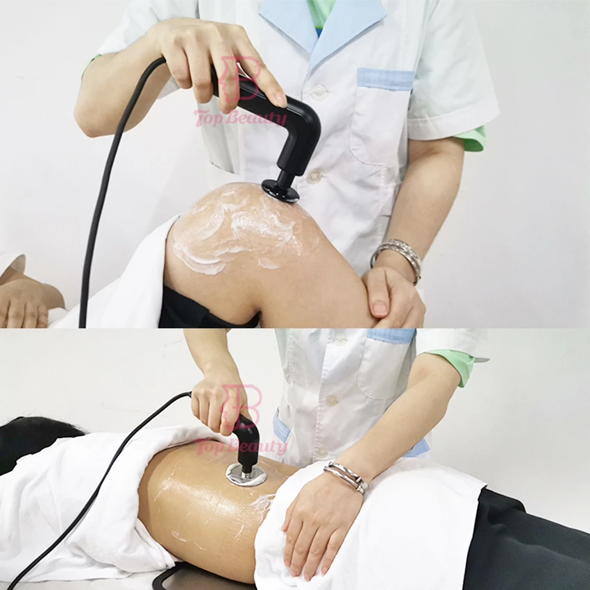 Indiba Diathermy Tecarterapia Smart Machine Rf Deep Fat Burning Tecar Physiotherapy