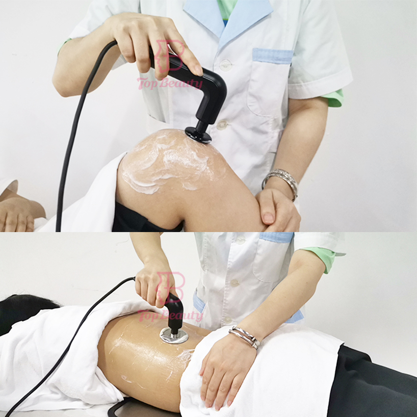 Indiba Diathermy Tecarterapia Smart Machine Rf Deep Fat Burning Tecar Physiotherapy