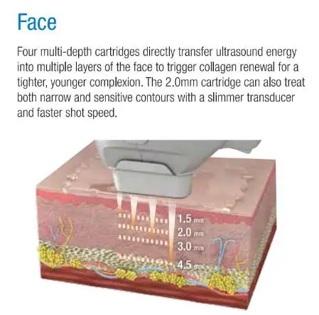 2024 skin tightening 2 in 1 Flx face lift hifu skin rejuvenation rf machine