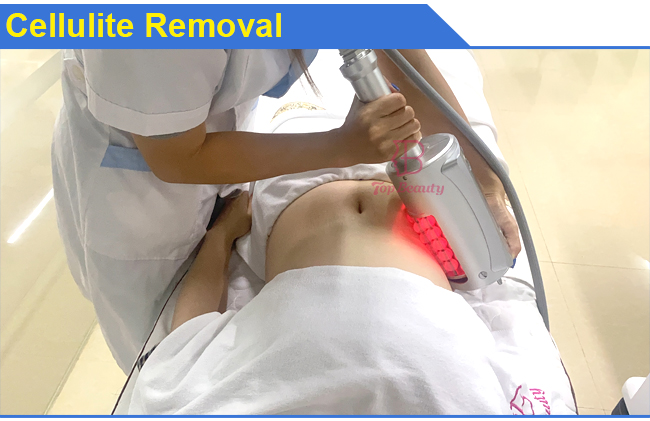 Endospheres roller massage cellulite machine