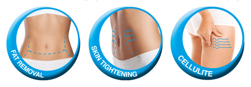 Best price cryolipolysis slimming machine cryotherapy weight lose fat freezing