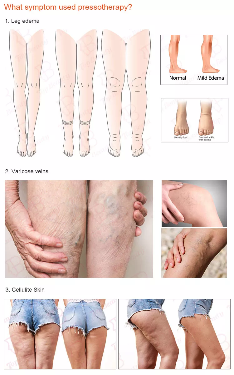 Professional boots pressotherapy lymph drainage machine massage