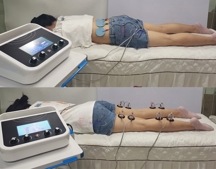 EMS Muscle Stimulator Body Slimming Russian Wave Electrostimulation Fair Cupping Breast Vacuum Therapy Machine