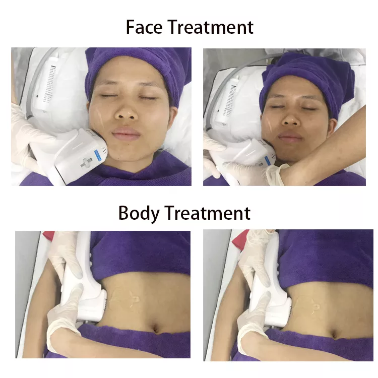 360 ° rotate display ultrasound skin rejuvenation Wrinkle Removal vertical 4D MMFU Machine