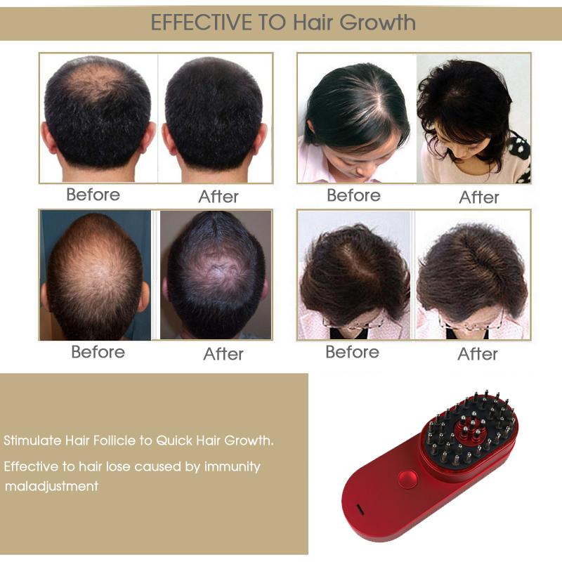 Portable Mini Electric Ionic Hair Brush Anti-Static Scalp Head Massage Comb Hair loss machine treatment Care