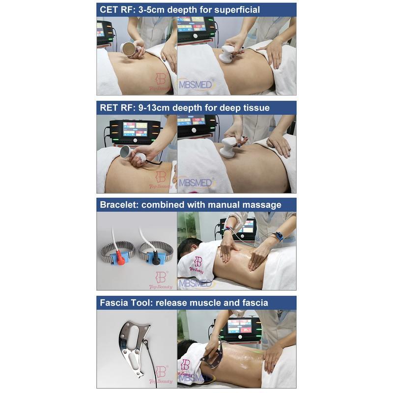 indiba Radiofrequency Therapy Cet Ret Tecar Indiba 448Khz Tecar Therapy Machine