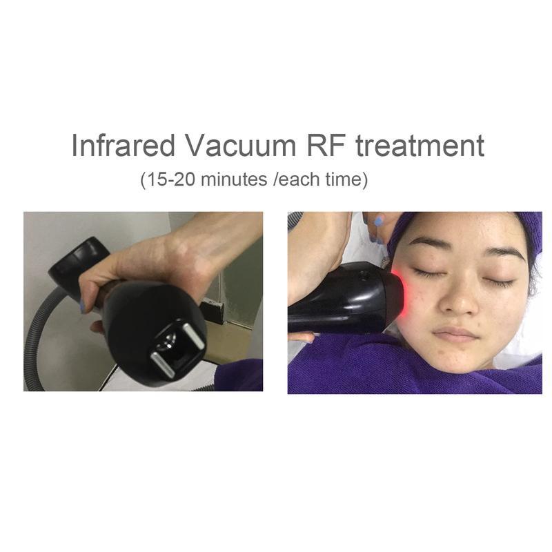 2023 New Arrival Fat Reduction Body Slimming Vacuum Roller Massage Bodyshaper