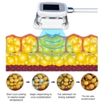 2022 360 Cryo Machine Cryolipolysis Best Price Fat Freezing Machine For Weight Loss Cryolipolysis