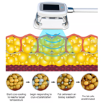 2022 360 Cryo Machine Cryolipolysis Best Price Fat Freezing Machine For Weight Loss Cryolipolysis