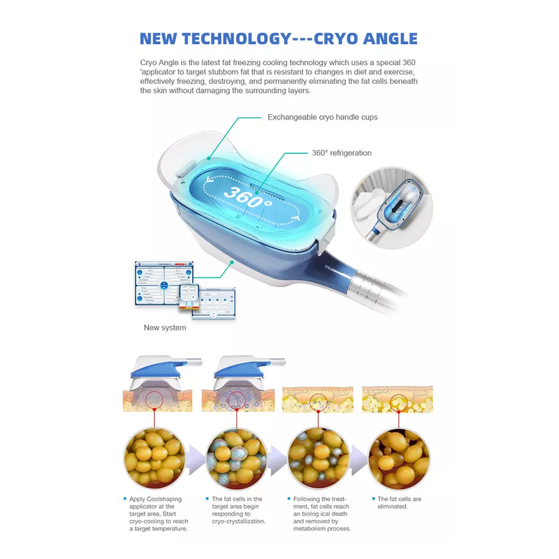 2022 360 Cryo Machine Cryolipolysis Best Price Fat Freezing Machine For Weight Loss Cryolipolysis