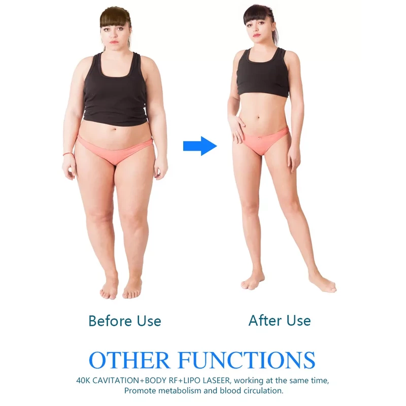 New arrivals 2022 portable cryolipolysis 360 fat freezing cool body sculpting machine / 360 cryolipolisis machine